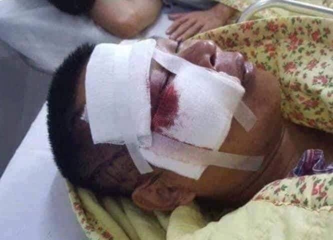 cu dan chung cu Hapulico buc xuc anh 2