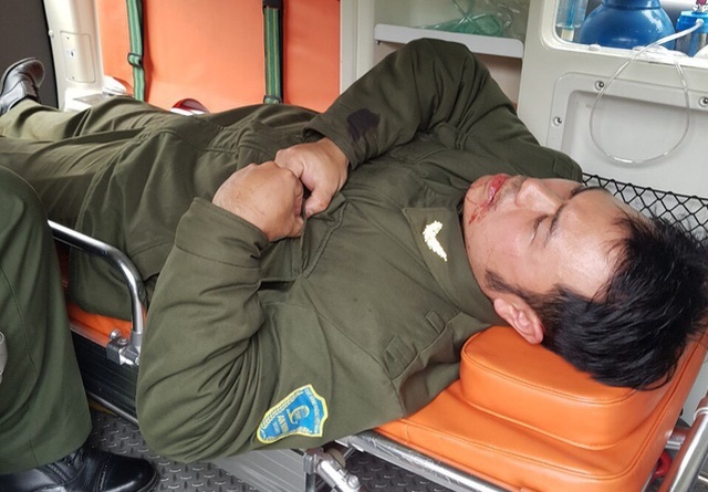 Nhan vien an ninh san bay Noi Bai bi 'co' taxi danh gay 4 rang cua hinh anh