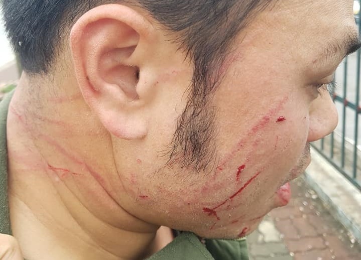 cò taxi hành hung an ninh ảnh 2 co taxi hanh hung an ninh anh 2