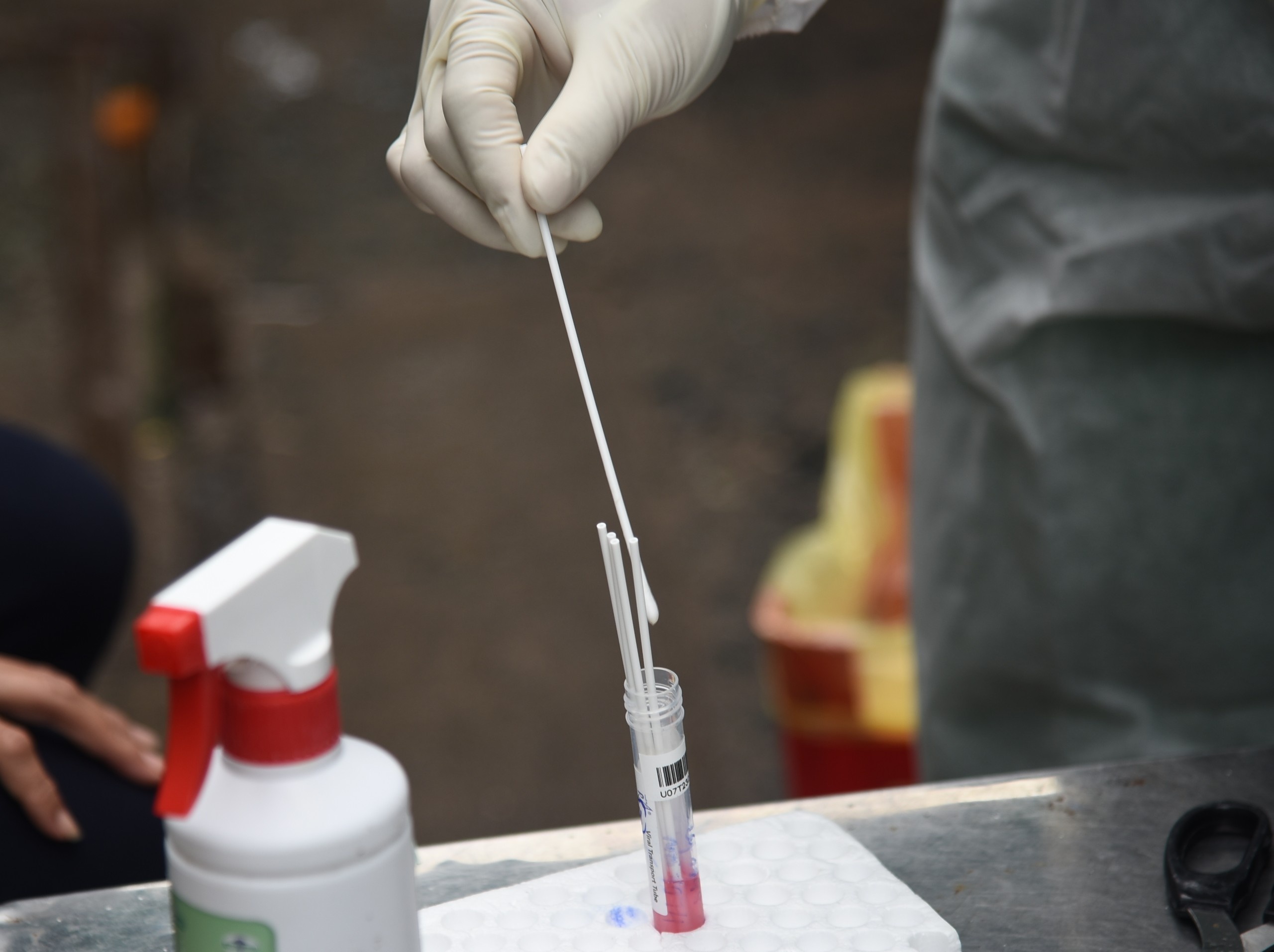 ca mac Covid-19 tu vong anh 2