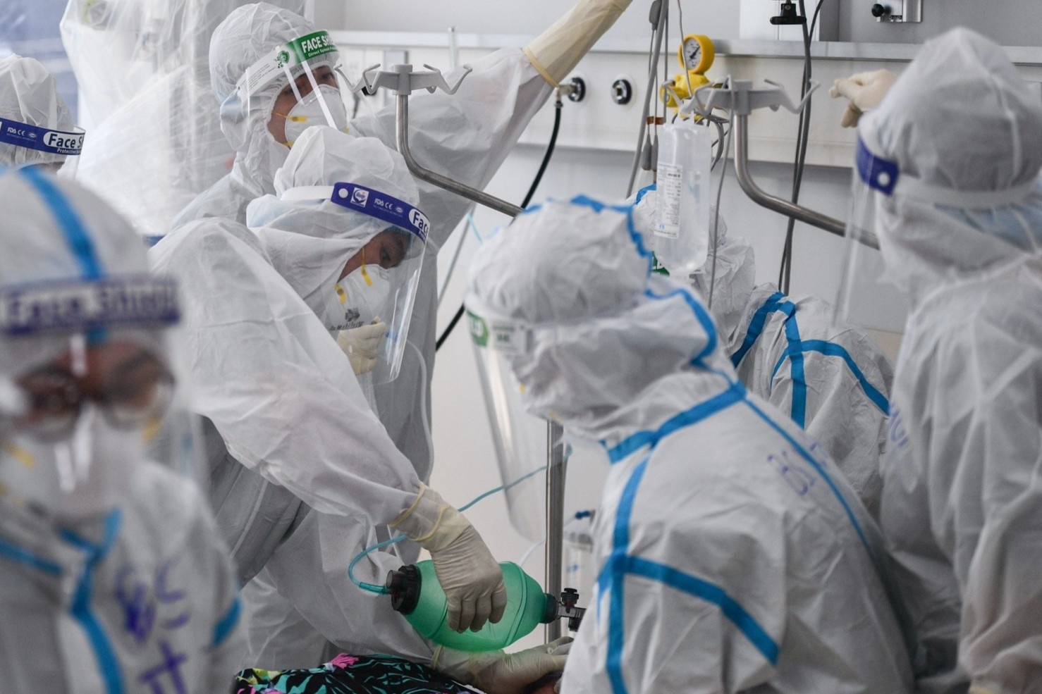 2 nguoi dung chung 1 may ECMO - sang kien cuu benh nhan nang hinh anh