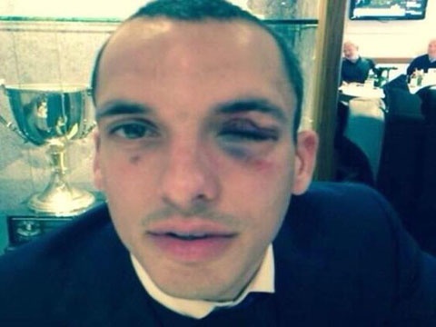 Pha va cham khien Leon Osman do mau hinh anh