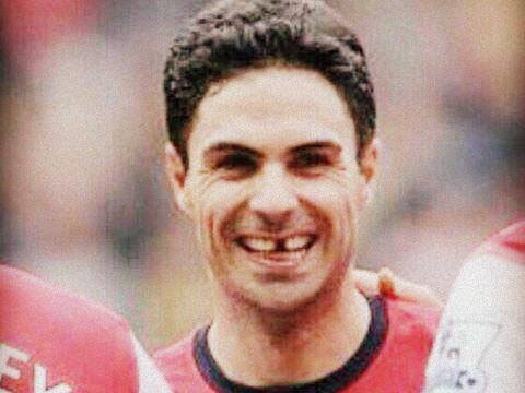 Pha va cham khien Arteta gay rang cua hinh anh