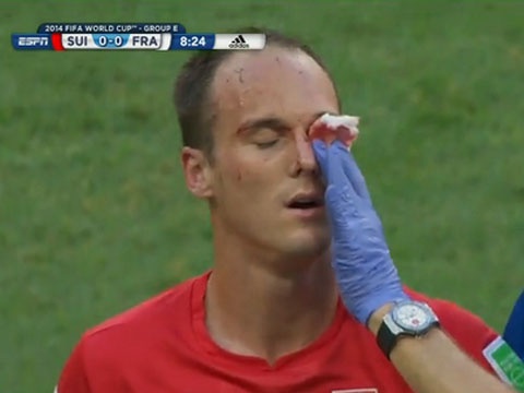 Giroud dap rach mat doi thu hinh anh