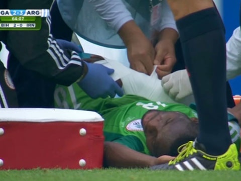 Cau thu gay tay sau pha sut cuc manh cua dong doi hinh anh