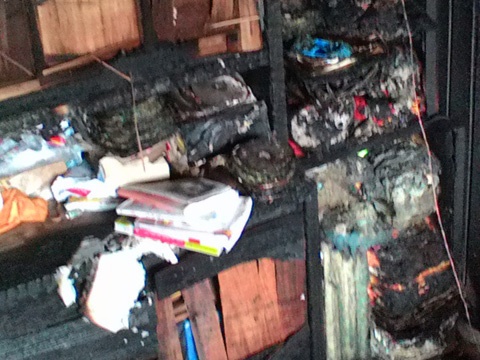 Keo vo khoi dam chay dua di cap cuu, mac do dac bi thieu rui hinh anh