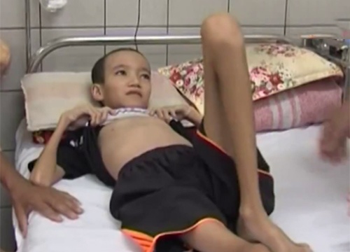 Be trai thoat chet than ky khi bi ap-xe nao gan 2 thang hinh anh