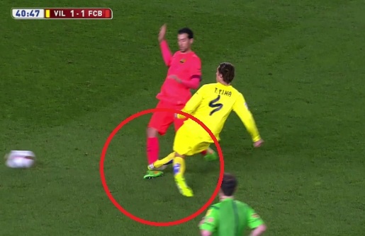 Busquets om mat roi san sau chan thuong nang hinh anh