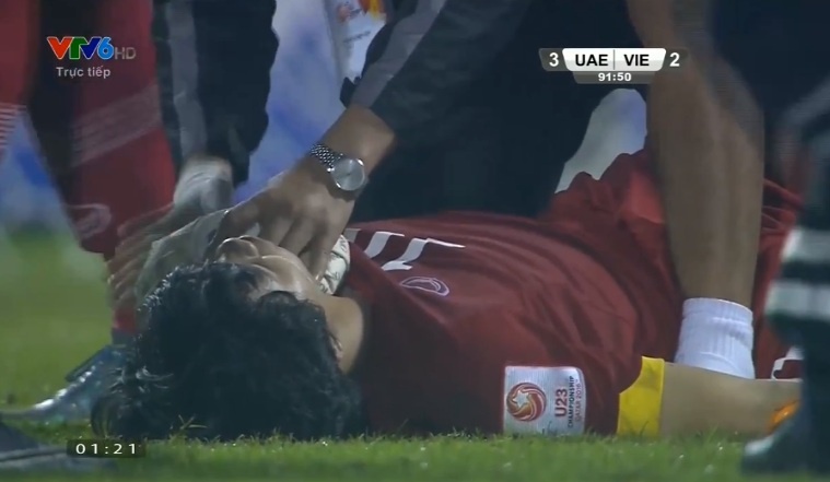 Tinh huong Cong Phuong gap chan thuong truoc U23 UAE hinh anh