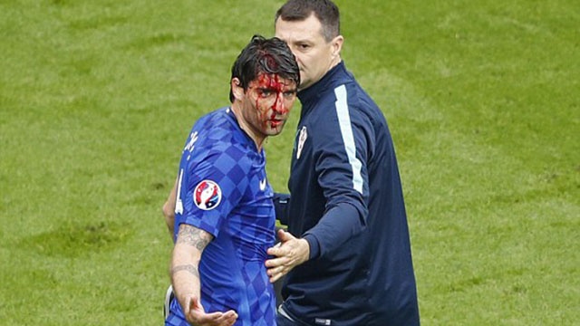 Tinh huong do mau cua cau thu Croatia hinh anh