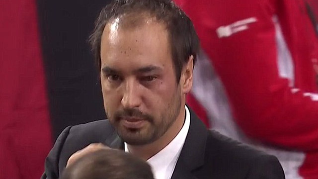 Tay vot suyt lam trong tai mu mat vi noi nong hinh anh