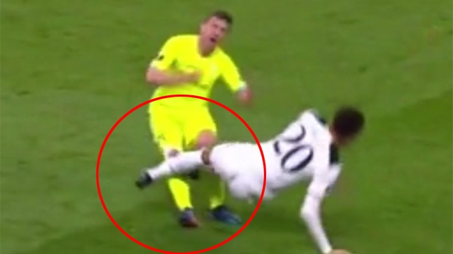 Dele Alli dap thang vao dau goi doi thu de tra dua hinh anh