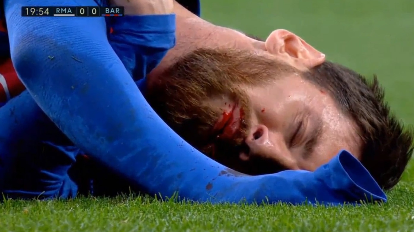 Messi chay mau mom sau pha va cham voi Marcelo hinh anh