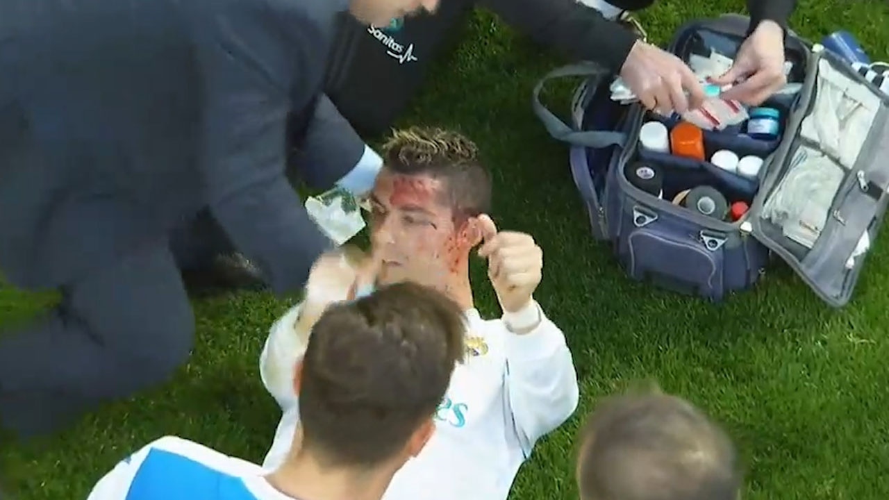 Ronaldo do mau sau pha danh dau ghi ban hinh anh