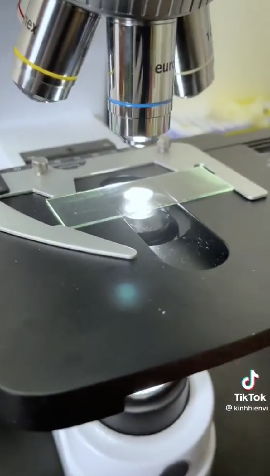 Thuy tien chia se video soi sua anh 2