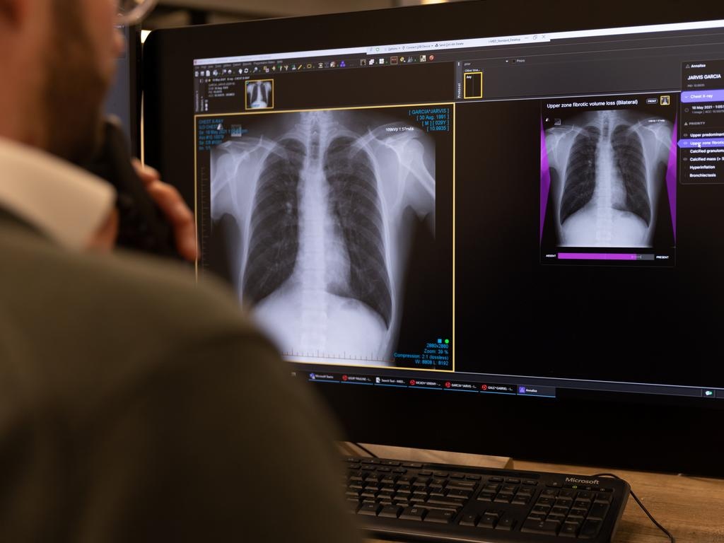 Ung dung AI de kham benh o Viet Nam hinh anh