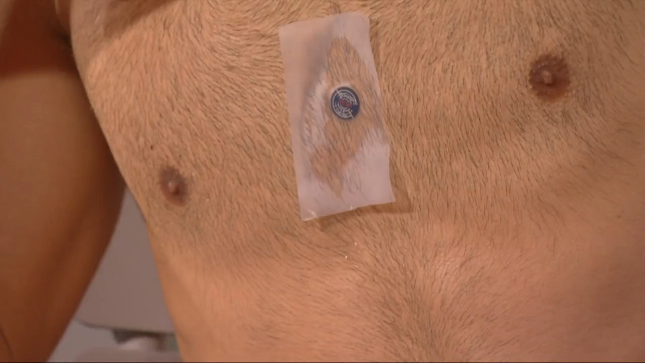 mieng dan Djokovic anh 1