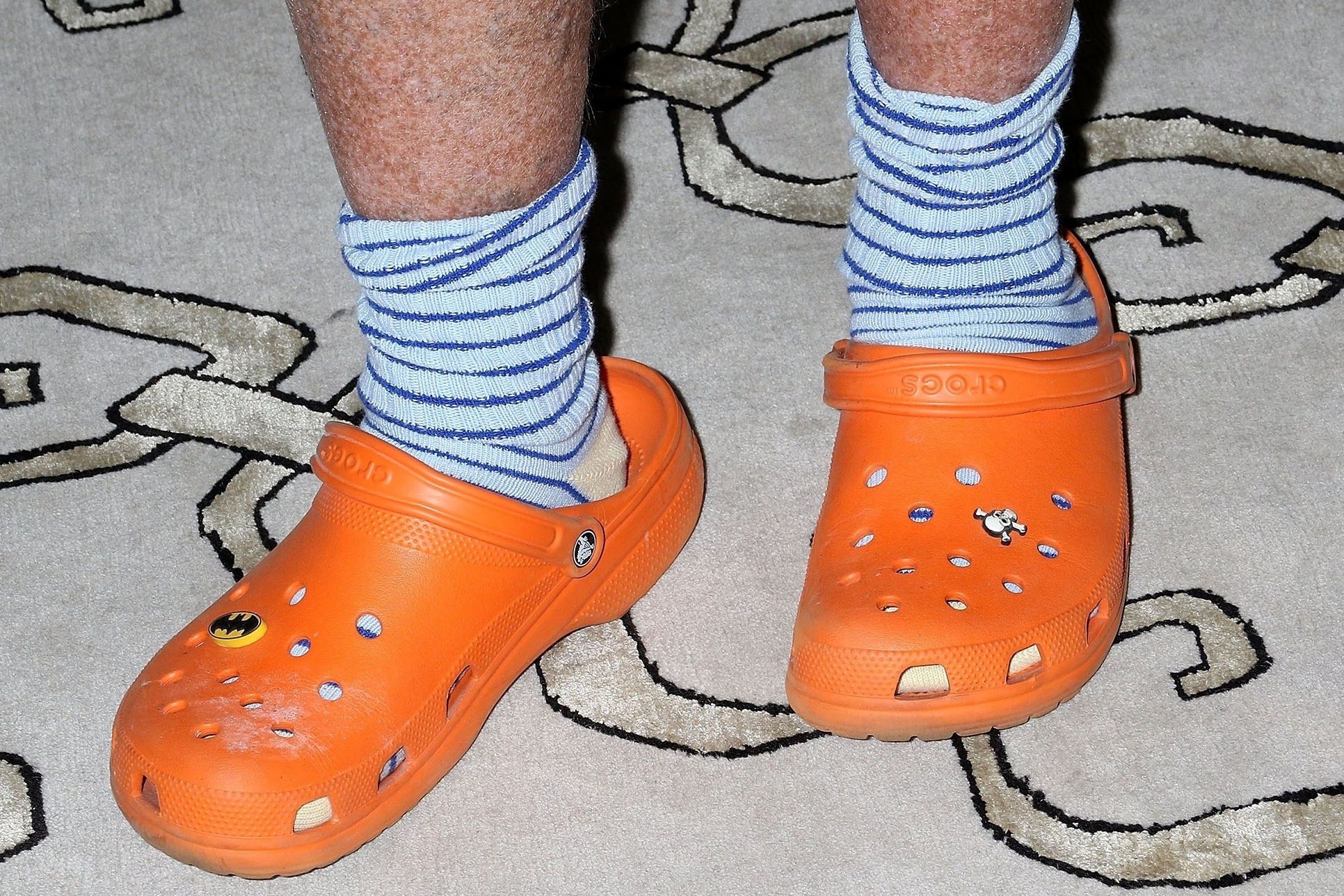 Crocs bao lo, giay 'xau xi' sap het thoi? hinh anh