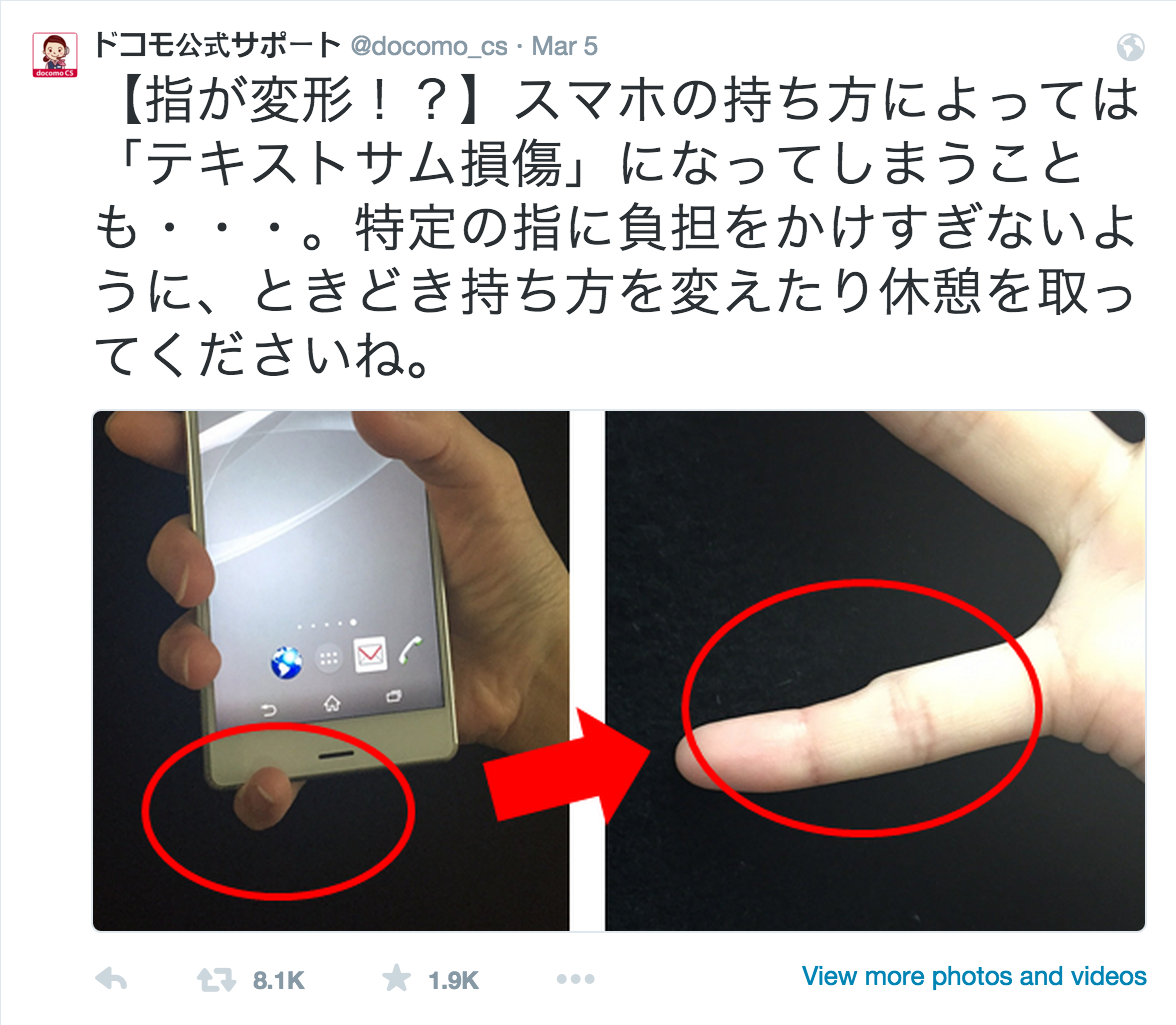 Ngon tay ut bi bien dang neu dung smartphone qua nhieu? hinh anh