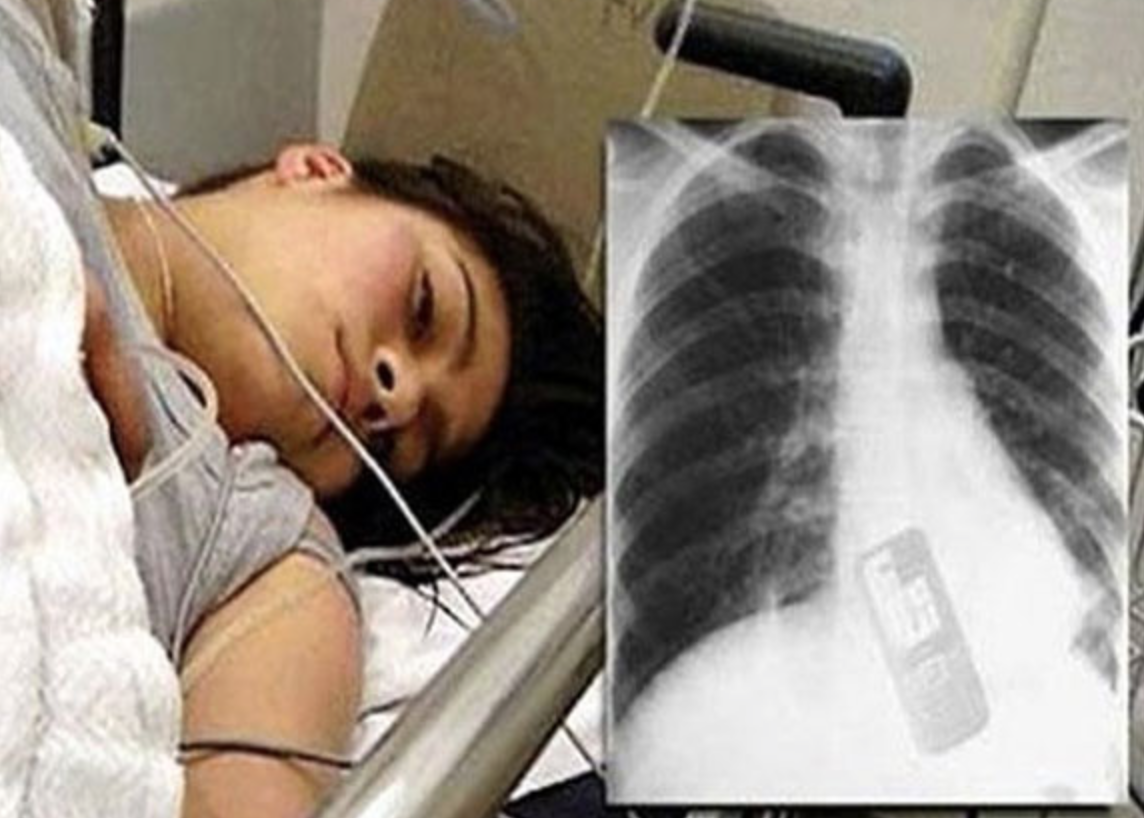 Tu nhan nhap vien vi nuot dien thoai hinh anh