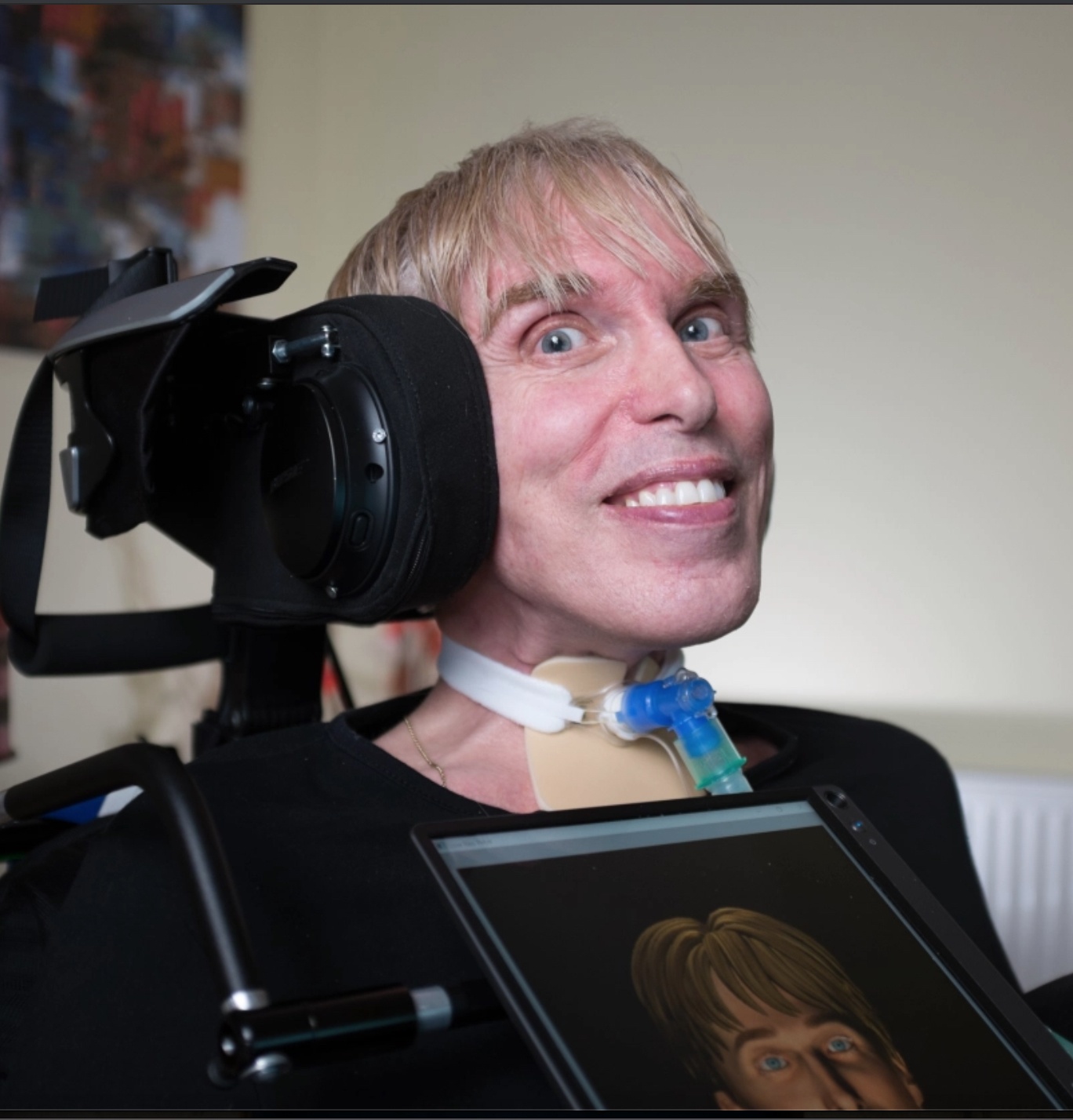 Tien si Peter Scott-Morgan tro thanh nguoi lai may anh 1