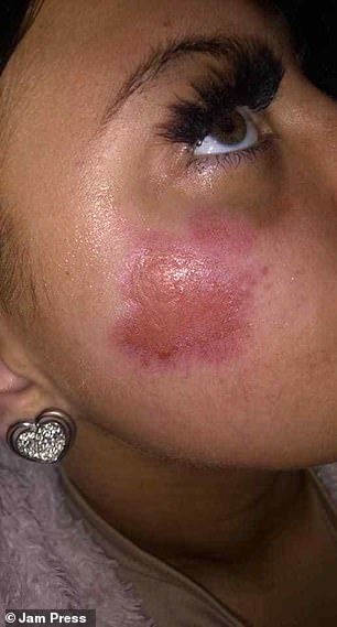 Sac iPhone phat no trong dem anh 2