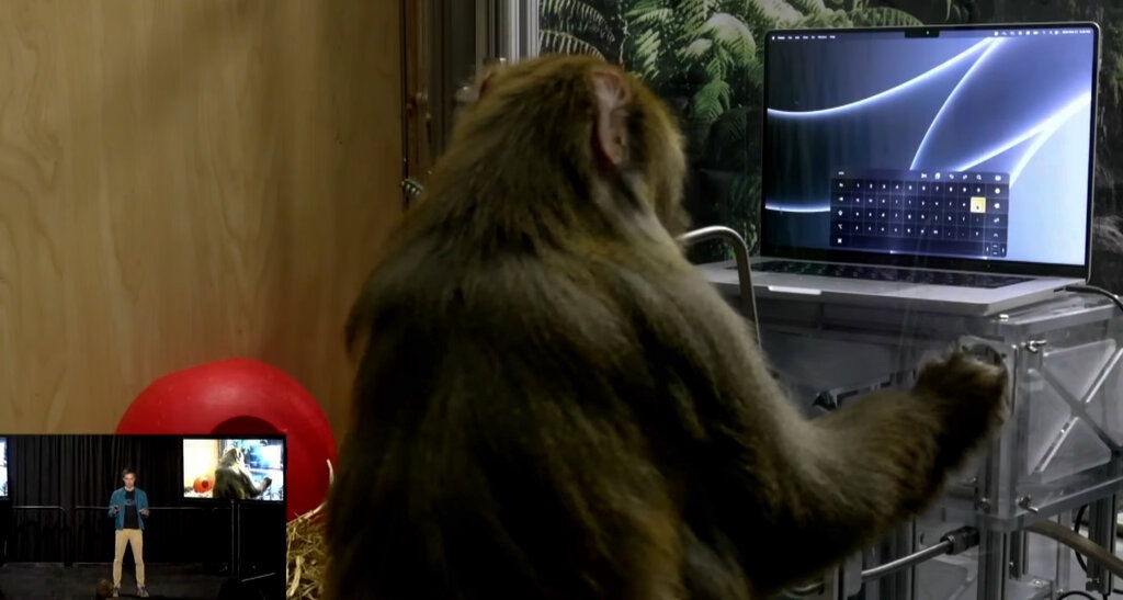 Chip Neuralink cua Elon Musk anh 2