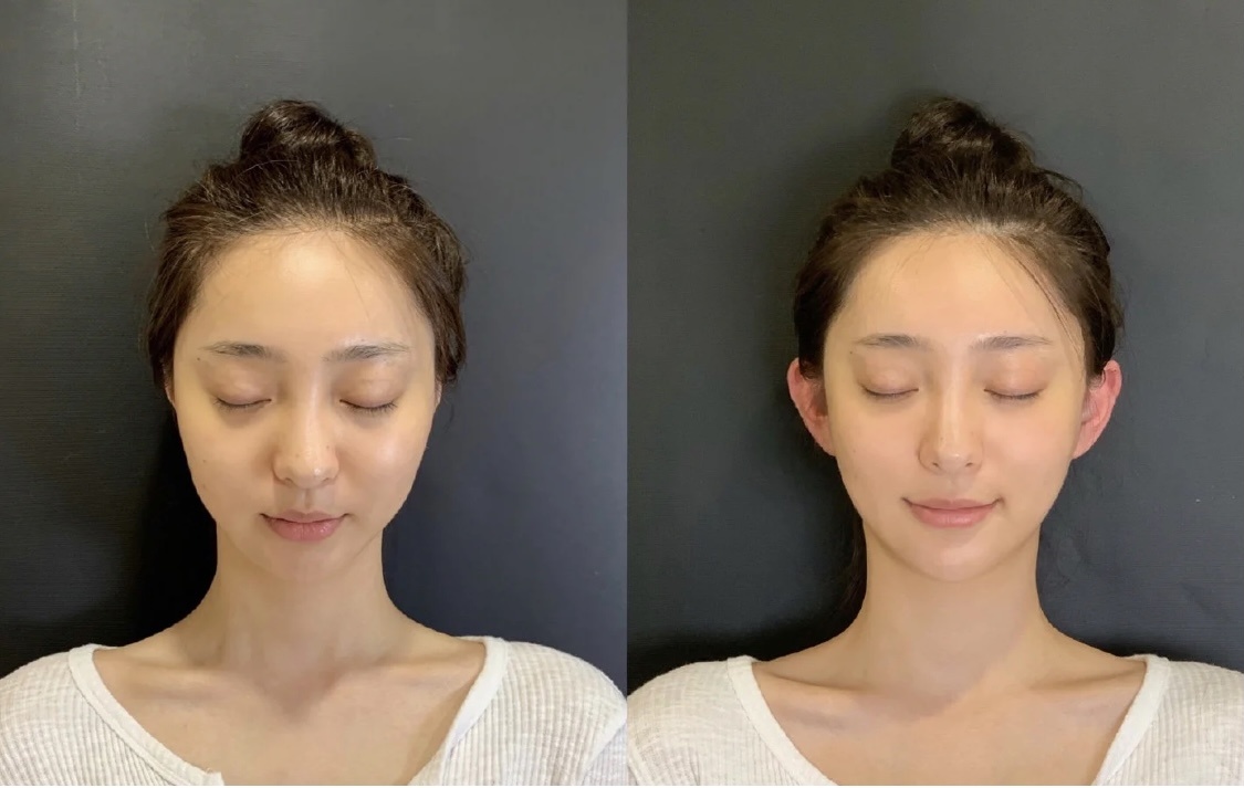 phẫu thuật thẩm mỹ ảnh 5 phau thuat tham my anh 5