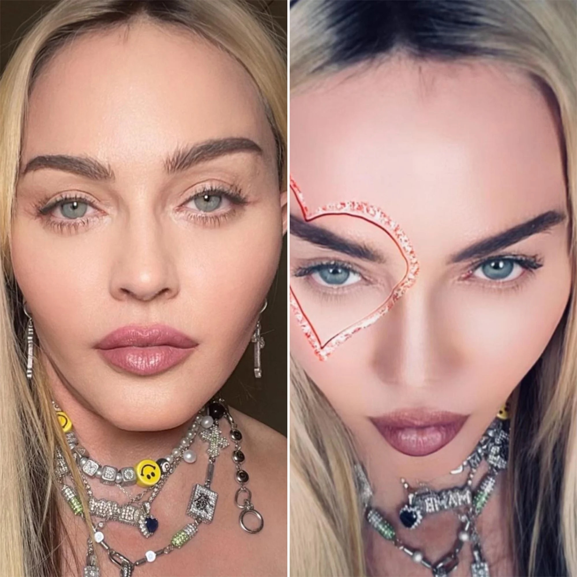 phau thuat tham my anh 4