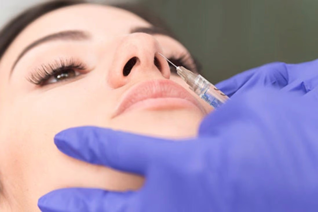 nang mui tu nhien anh 1