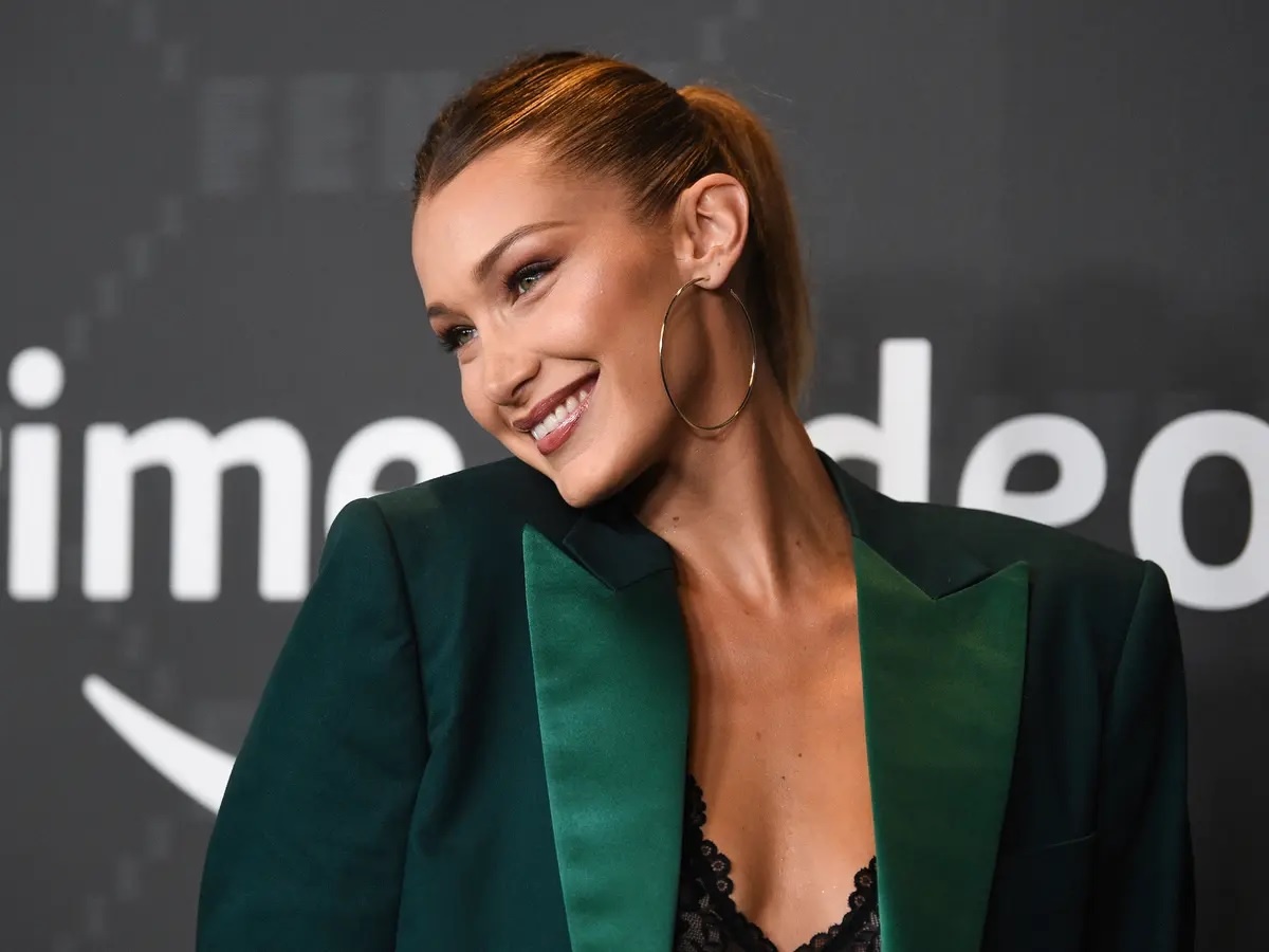 sao Hollywood chong lai botox anh 15