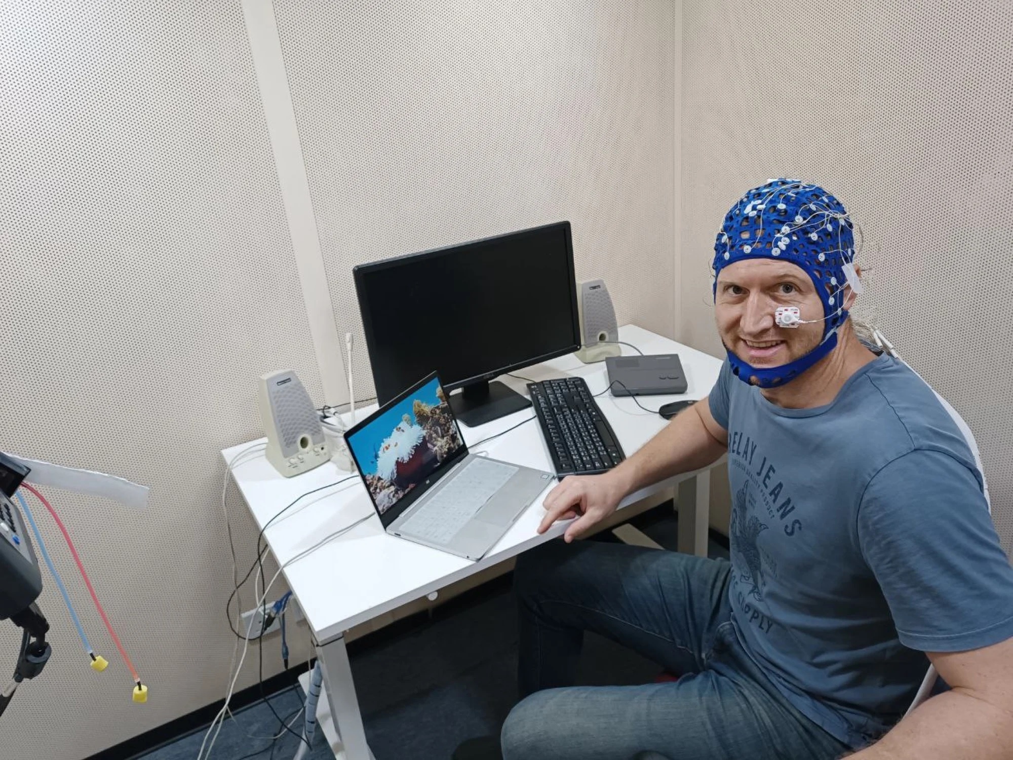 nghien cuu ve nao anh 1