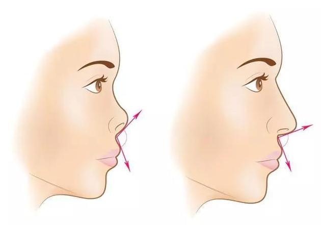 cach tao khoi cho mui anh 7