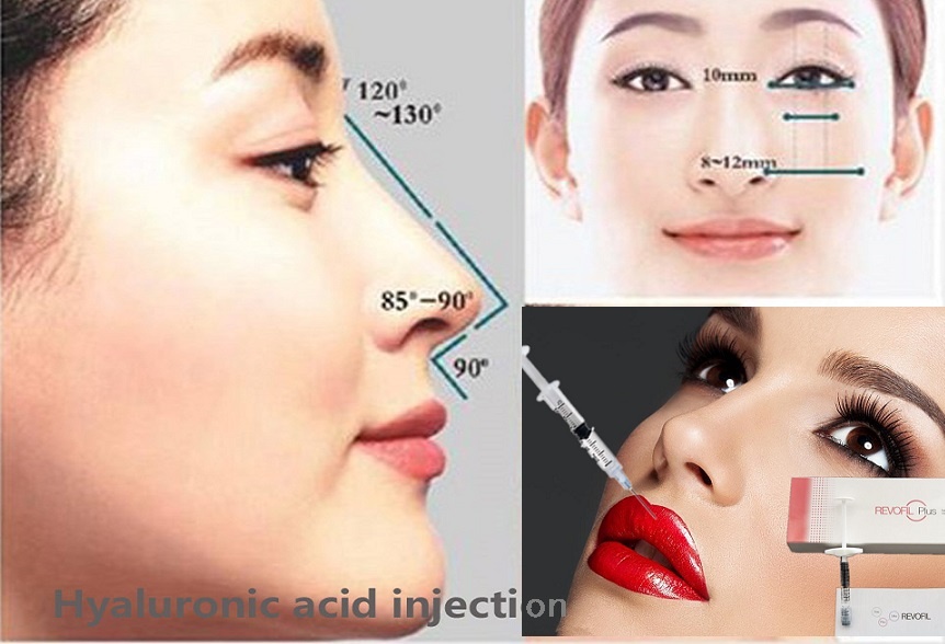 tiem filler co dau khong anh 3