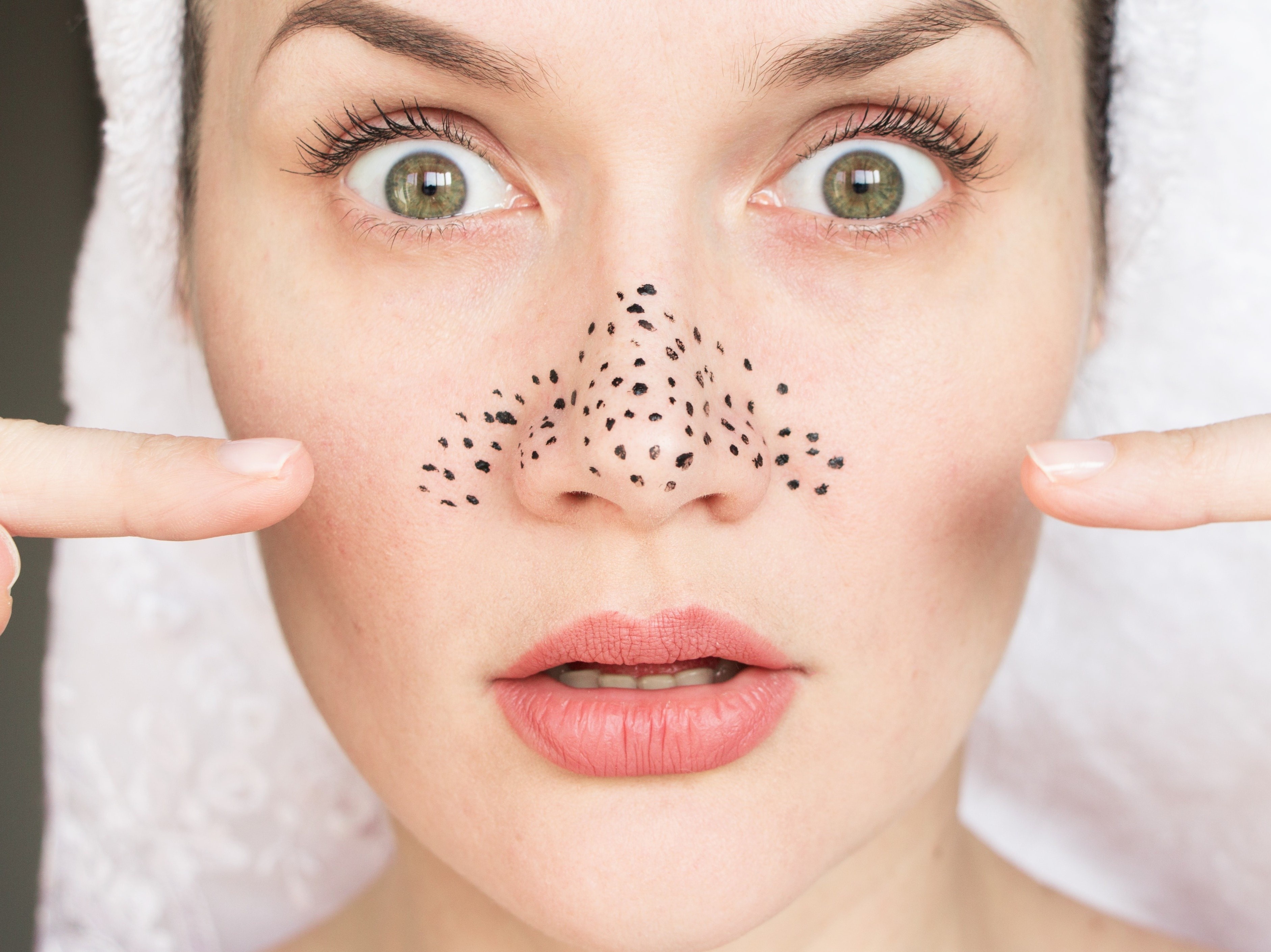 Loai bo mun dau den bang nguyen lieu san co tai nha hinh anh