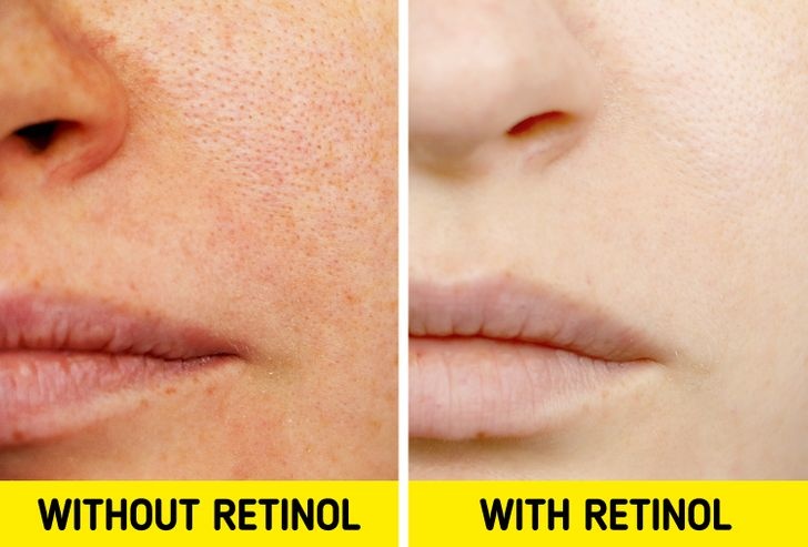 thói quen khiến da bị tắc nghẽn lỗ chân lông ảnh 1 thoi quen khien da bi tac nghen lo chan long anh 1