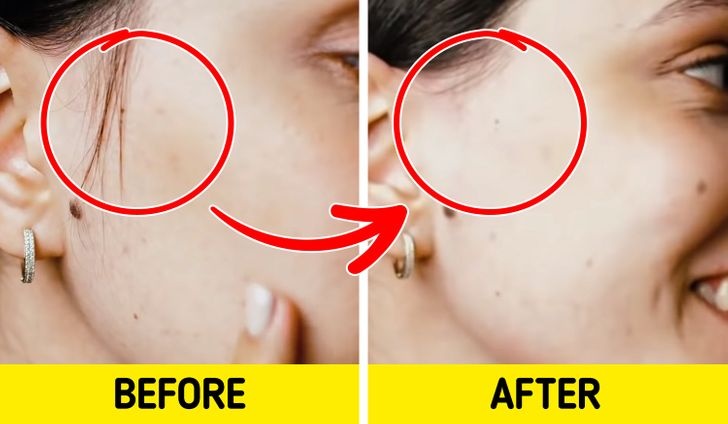 cach de loai bo long mat anh 3