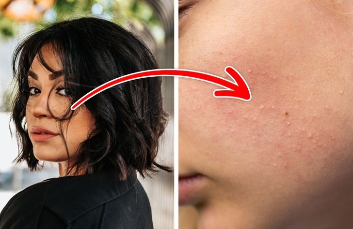 thói quen khiến da bị tắc nghẽn lỗ chân lông ảnh 6 thoi quen khien da bi tac nghen lo chan long anh 6