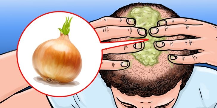 cach de toc moc nhanh anh 2