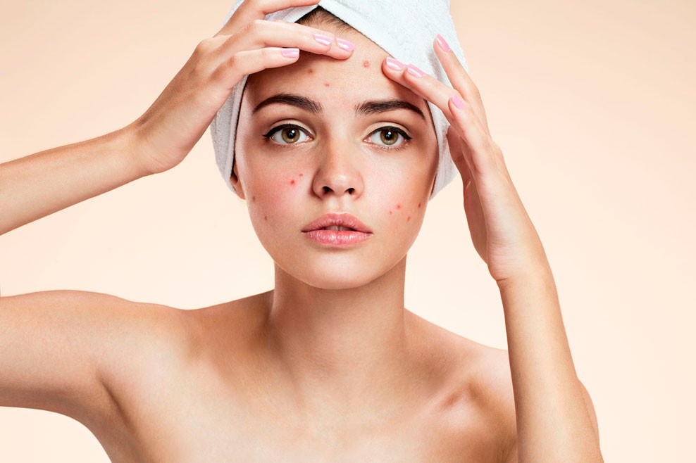 7 sai lam khien da ban noi mun hinh anh