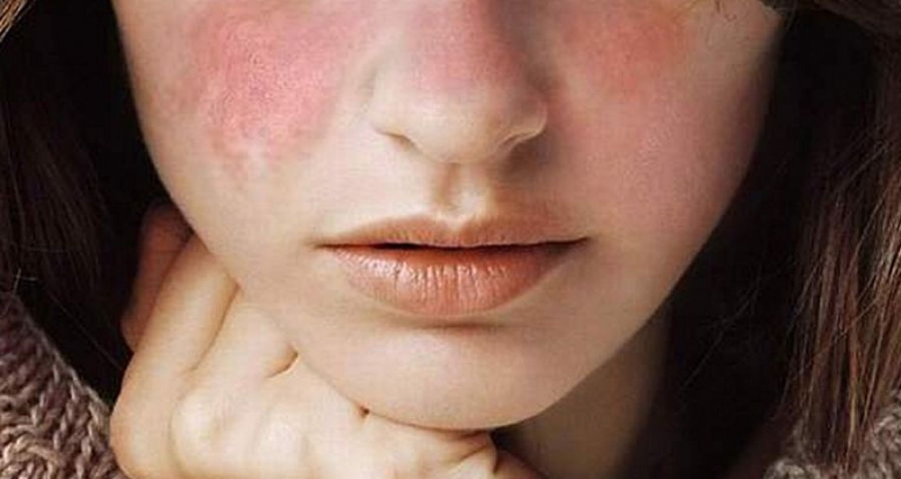 cham da khi thoi tiet giao mua anh 1