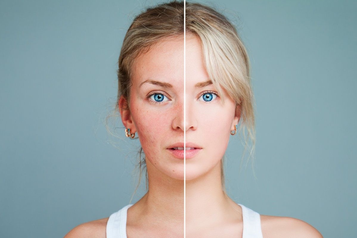 Bi quyet co lan da dep khi giao mua hinh anh