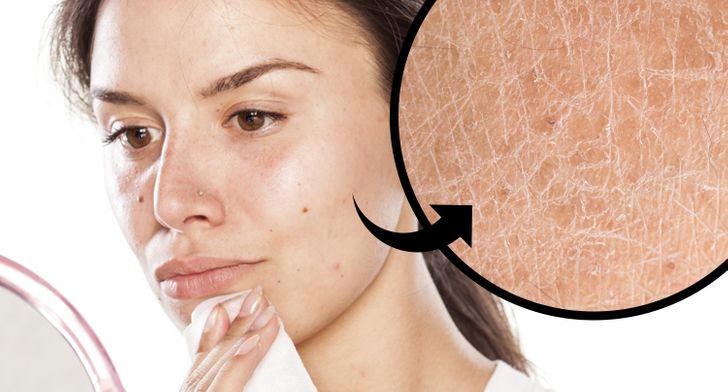 tác hại của khăn ướt tẩy trang ảnh 1 tac hai cua khan uot tay trang anh 1