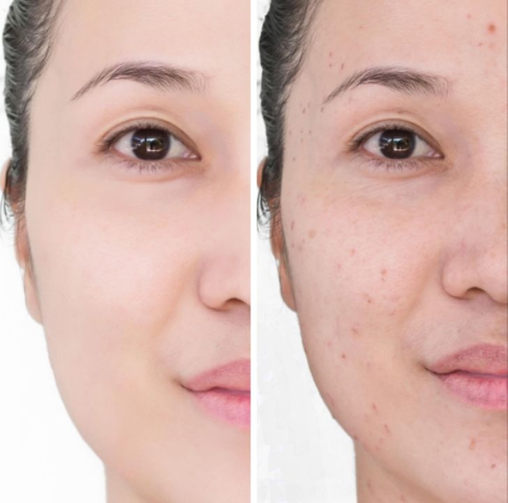 tác hại của khăn ướt tẩy trang ảnh 2 tac hai cua khan uot tay trang anh 2