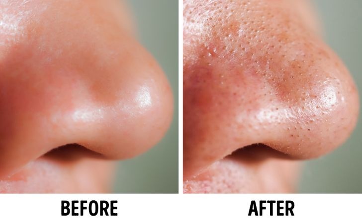 tác hại của khăn ướt tẩy trang ảnh 3 tac hai cua khan uot tay trang anh 3