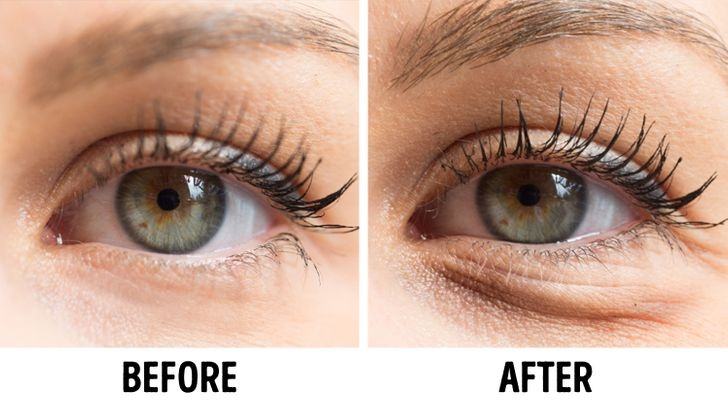tác hại của khăn ướt tẩy trang ảnh 5 tac hai cua khan uot tay trang anh 5