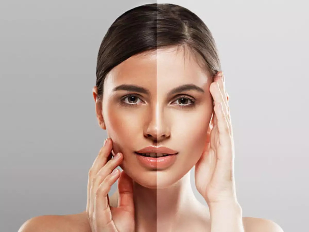 cay lan ngoc bich anh 1