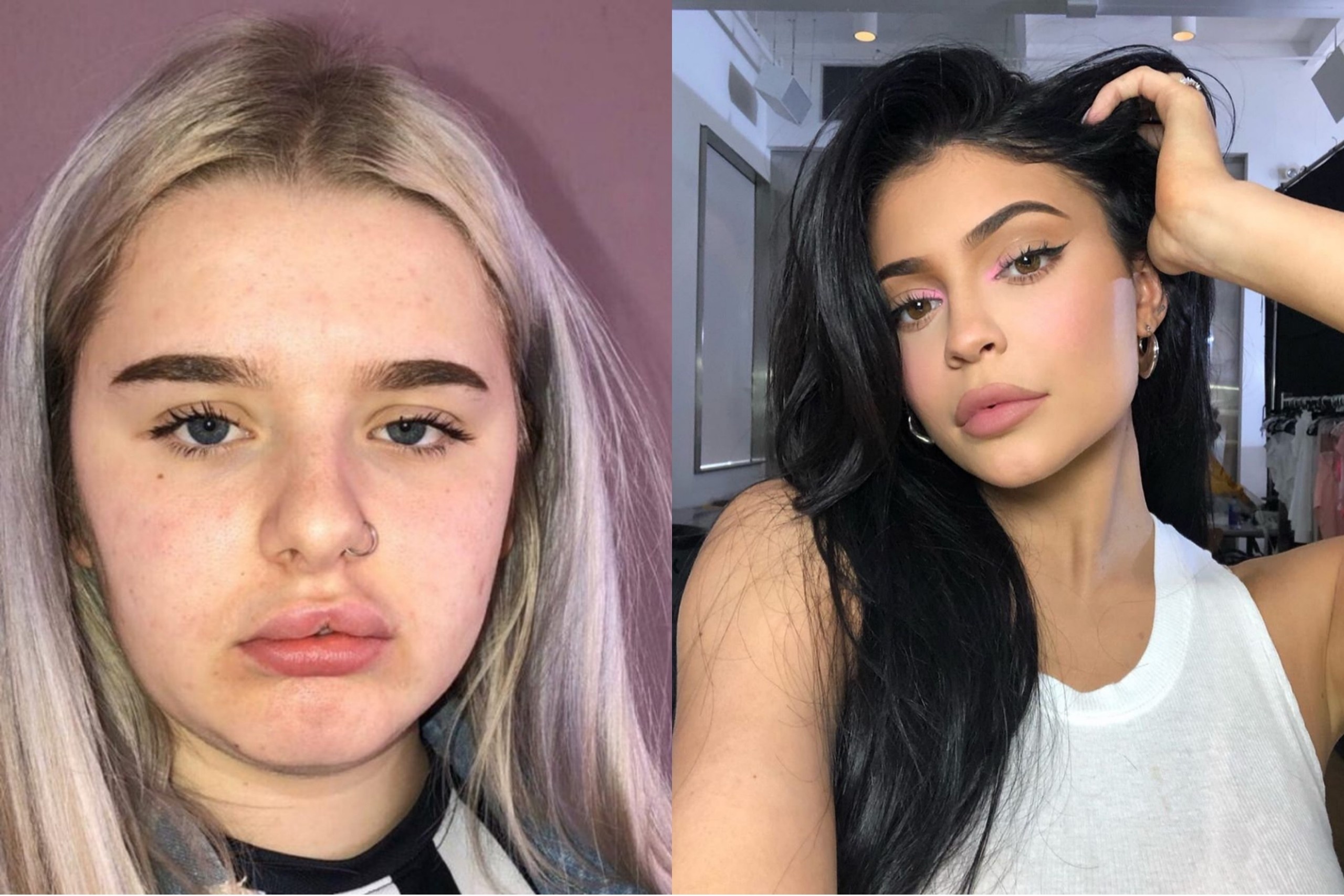 Nu sinh dau don khi bom moi giong Kylie Jenner hinh anh