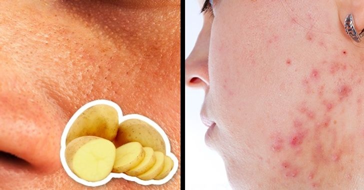 sai lam ve lam dep anh 2