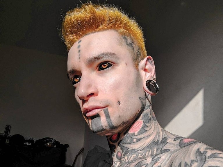 xam nhan cau la gi anh 4